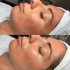 KRX_Serum_Inflacure_Rosacea_Acne_.webp